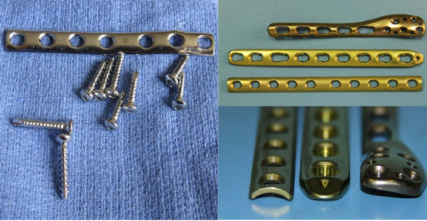 Plat Logam yang Dipasang di Kaki Cal Crutchlow Hampir Sekilo Beratnya