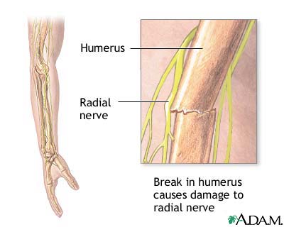 Nekat! Keputusan Akhir Marquez Hari Jumat 2 radial nerve