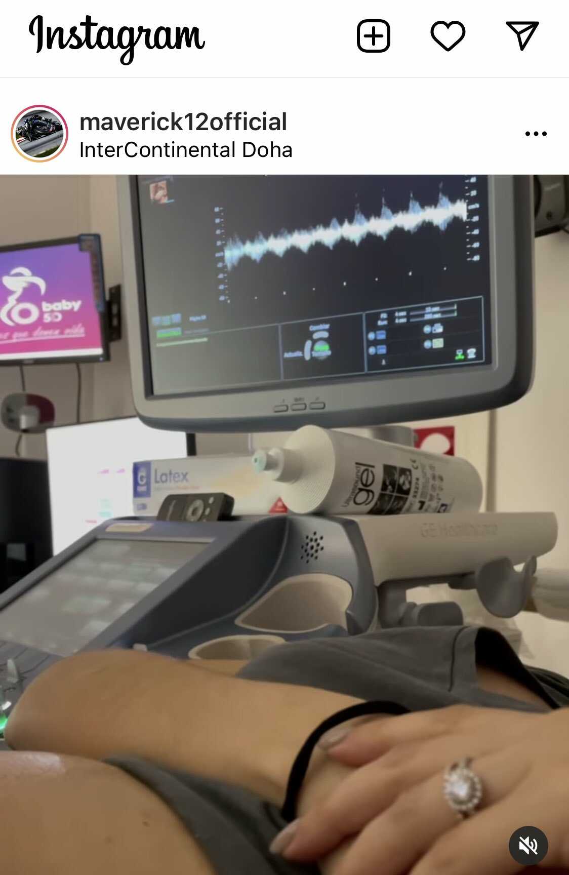 vinales menjadi ayah 1