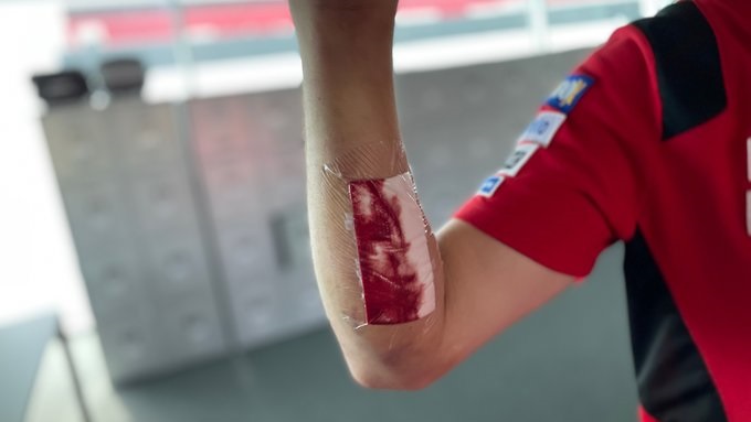 Akibat Crash, Jahitan Bekas Operasi Jack Miller Sobek, Giliran Butuh Taxi Dia Gak Dapat! 1 Jack Miller Crash 1