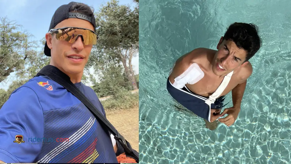 Marc Marquez Kini Bisa Berlatih Olahraga Ringan 1 Marc Marquez 3