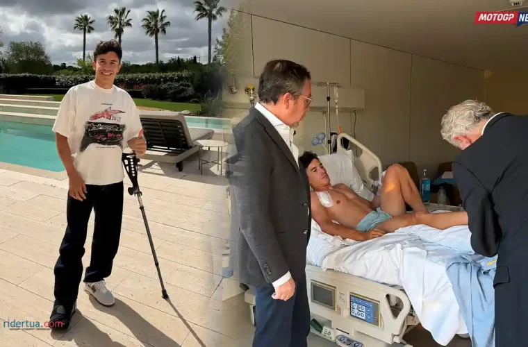 Marc Marquez operasi sukses