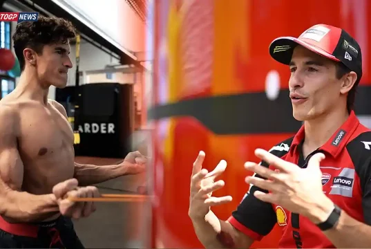 Marc Marquez Hand